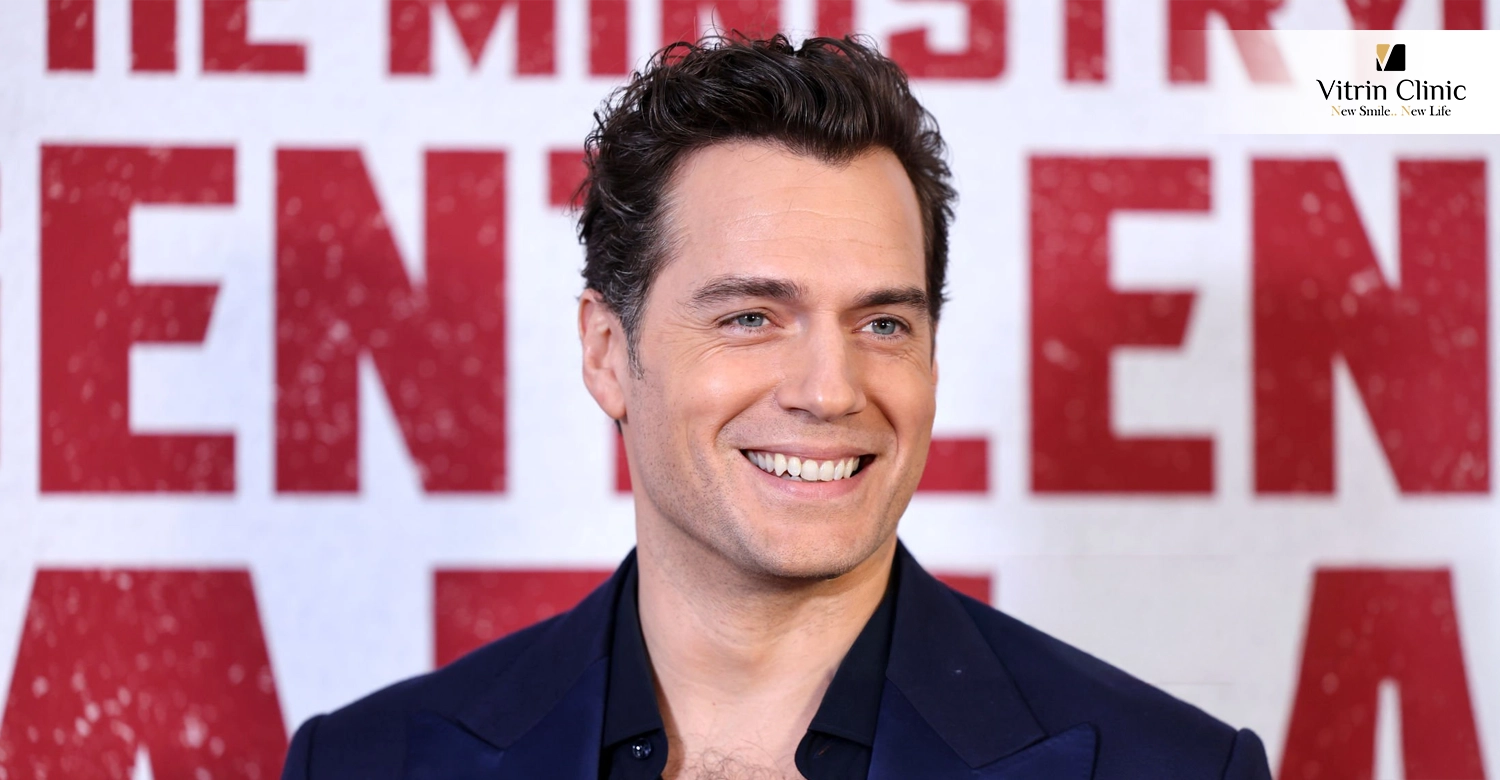Henry Cavill Teeth