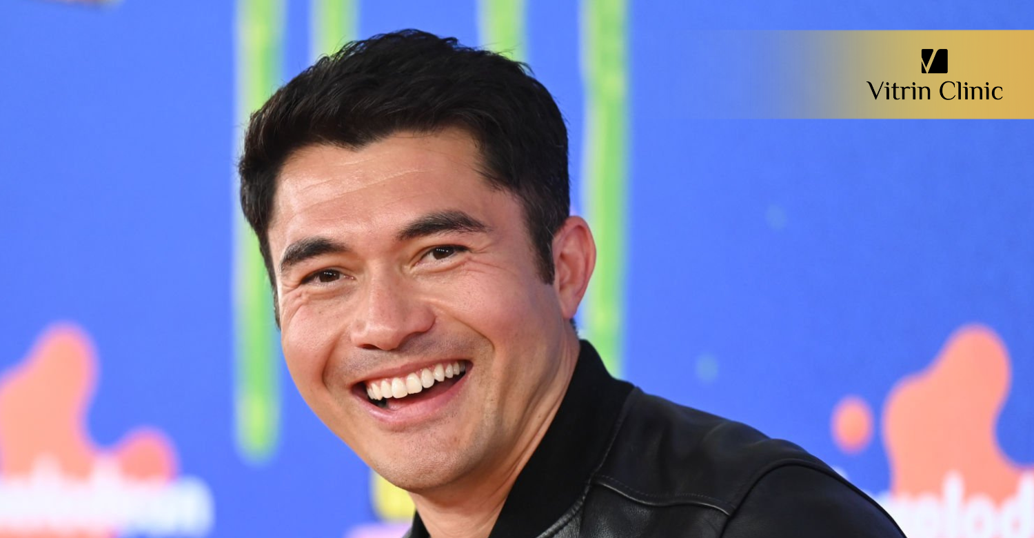 What Can We Learn From Henry Golding's Smile Evolution?