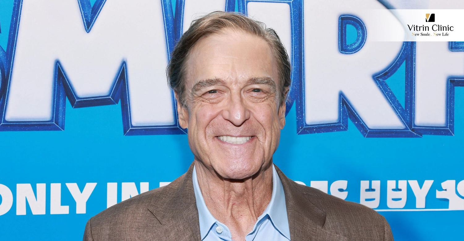 John Goodman Teeth
