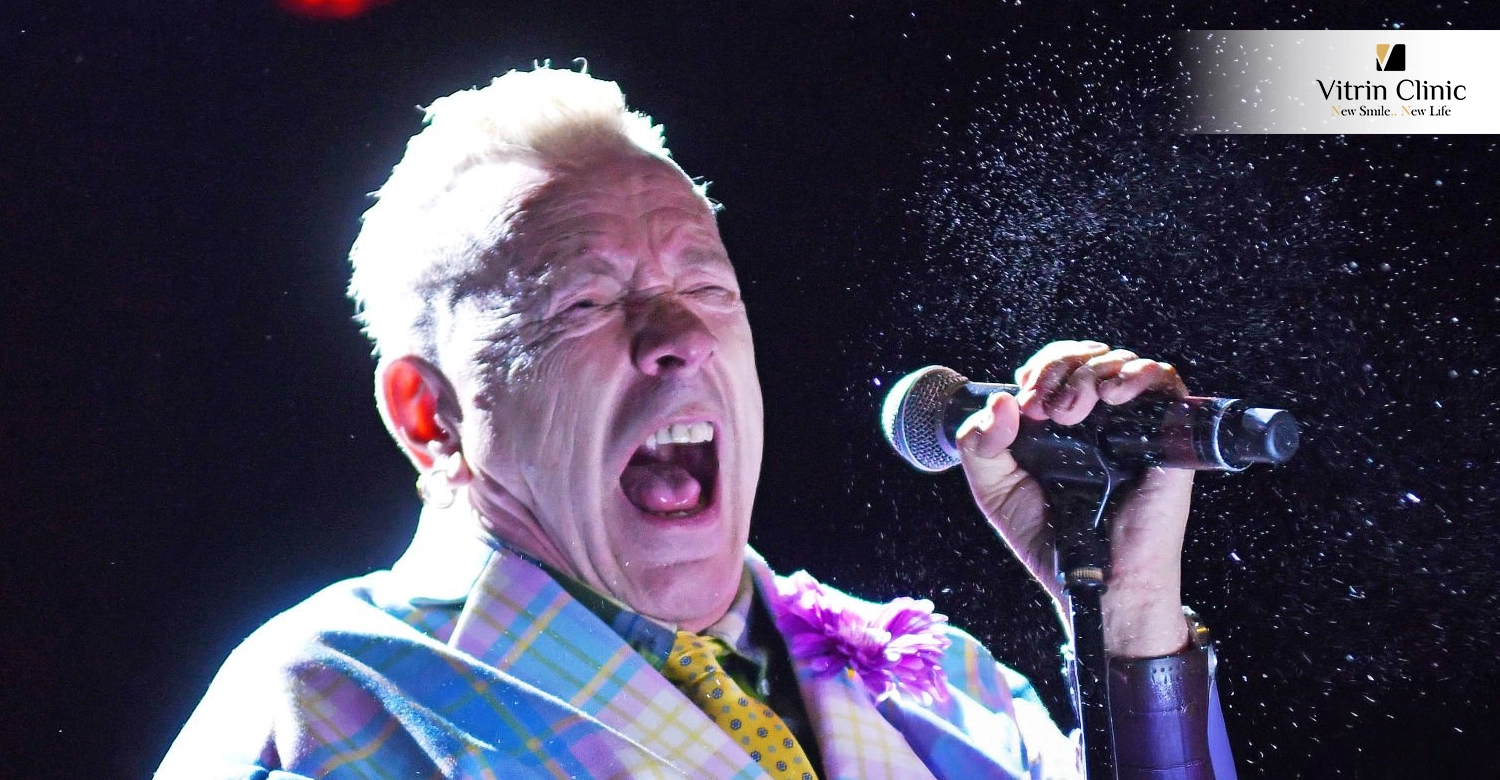 Johnny Rotten Smile