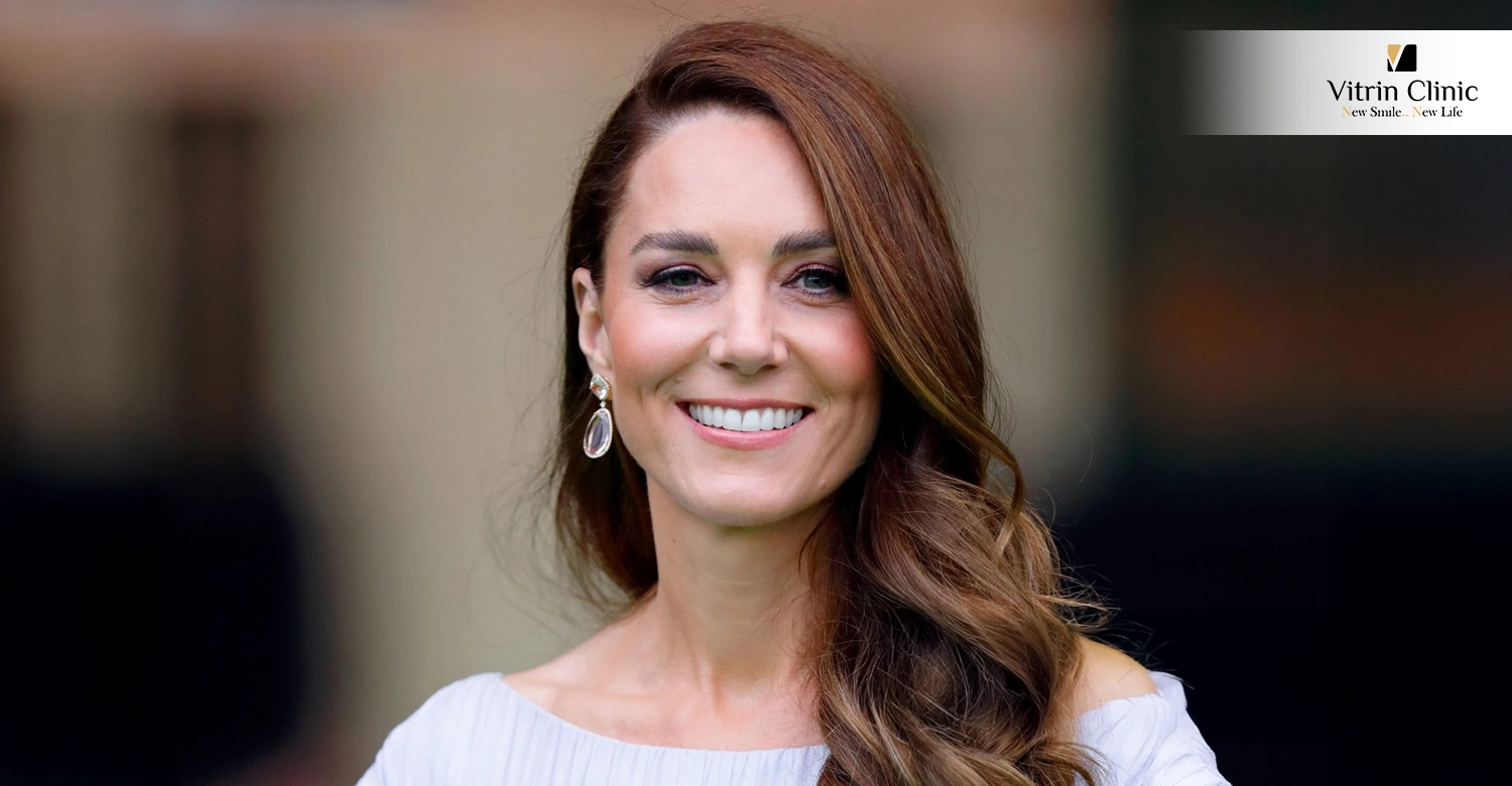 Kate Middleton Teeth