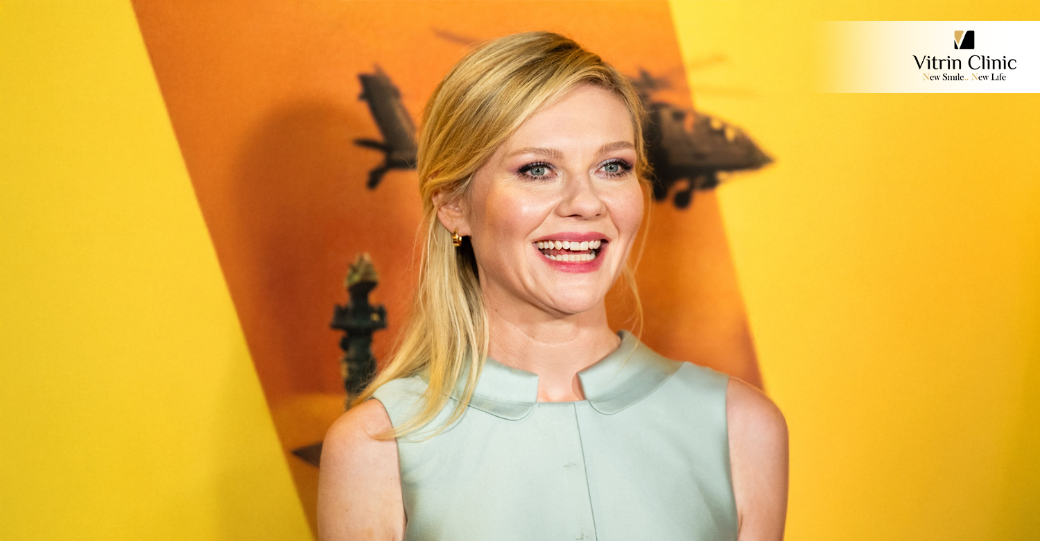 Kirsten Dunst Teeth
