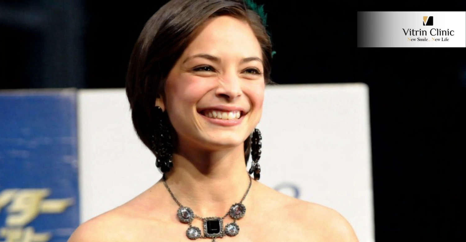 Kristin Kreuk teeth