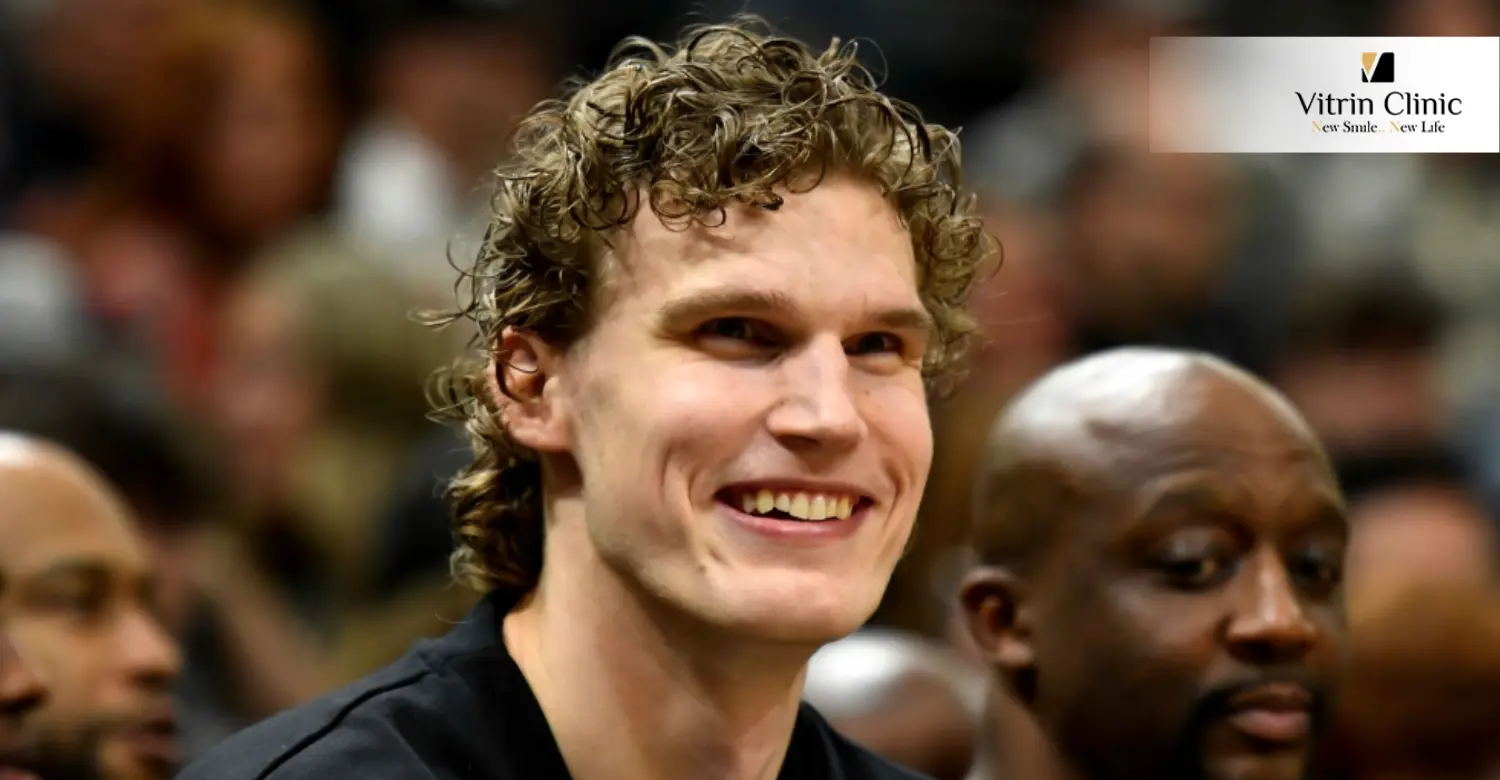 Lauri Markkanen Teeth: Celebrity Smile Transformation Explained