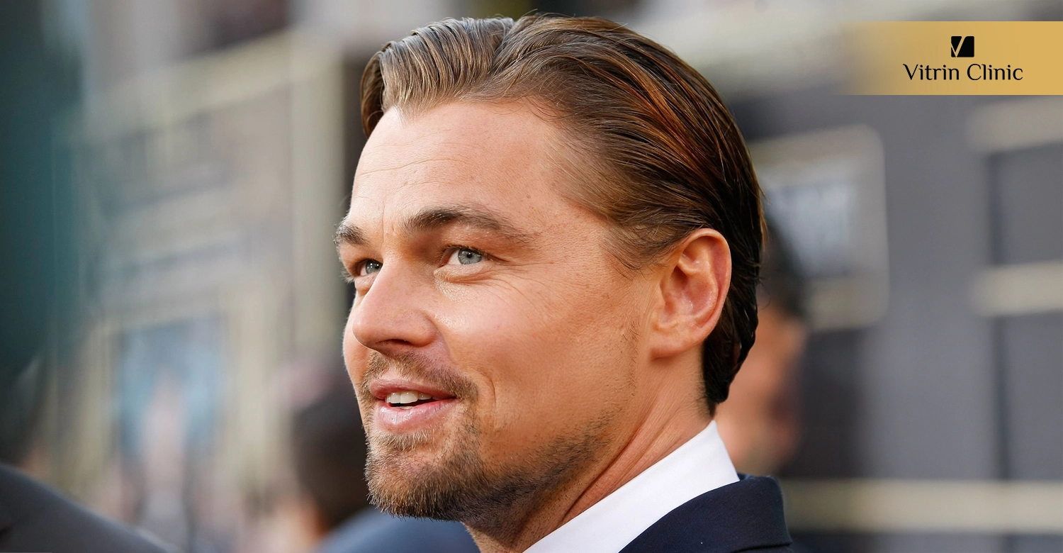 Dental Procedures to Recreate a Leonardo DiCaprio-Inspired Smile