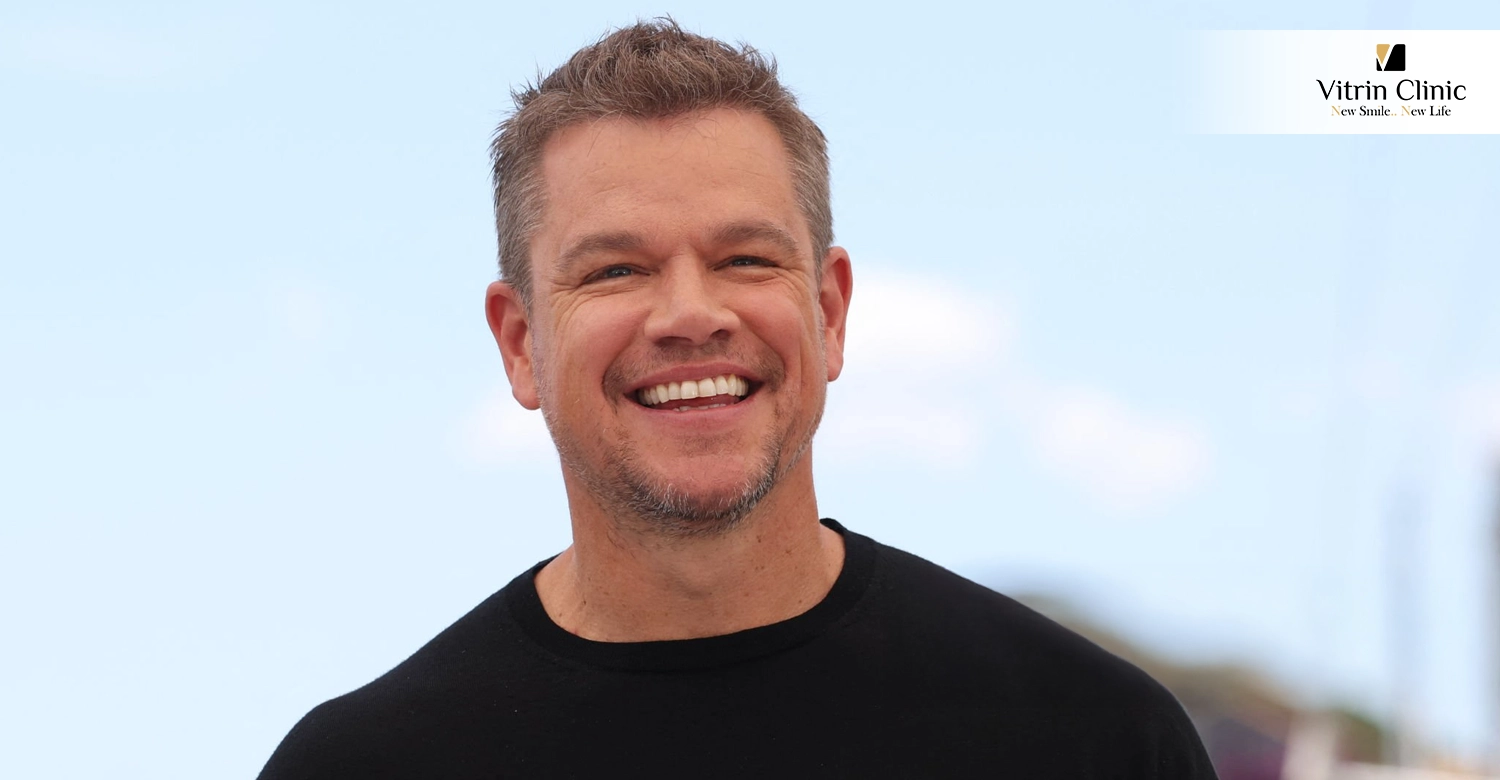 Matt Damon Teeth