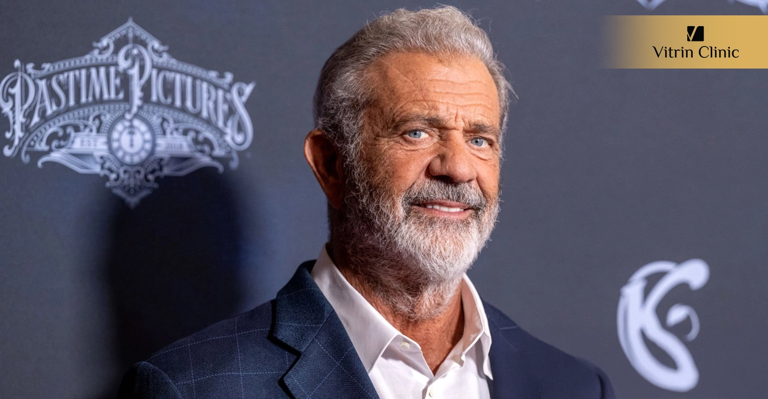 Dental Procedures to Recreate a Mel Gibson-Inspired Smile