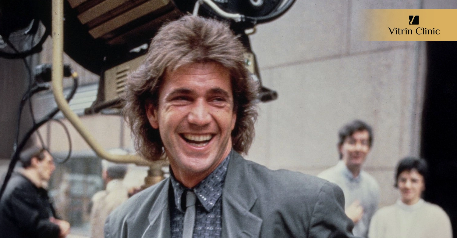 Signs of Professional Dental Work in Mel Gibson's Smile