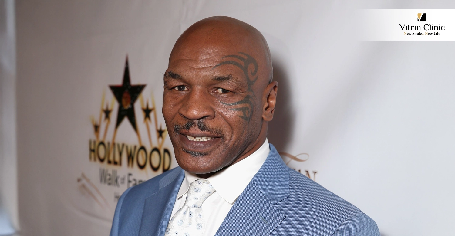 Mike Tyson Teeth