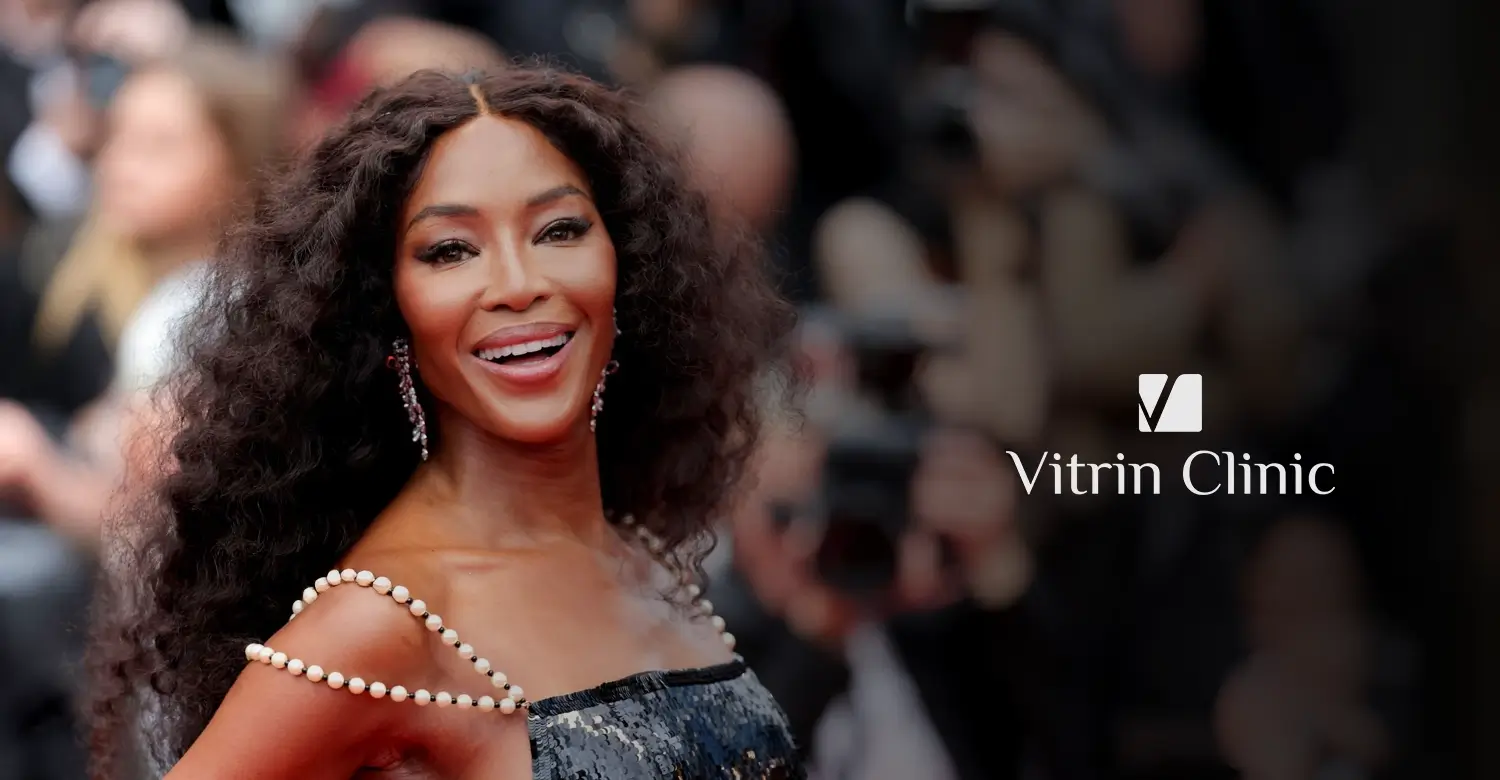 Naomi Campbell Teeth