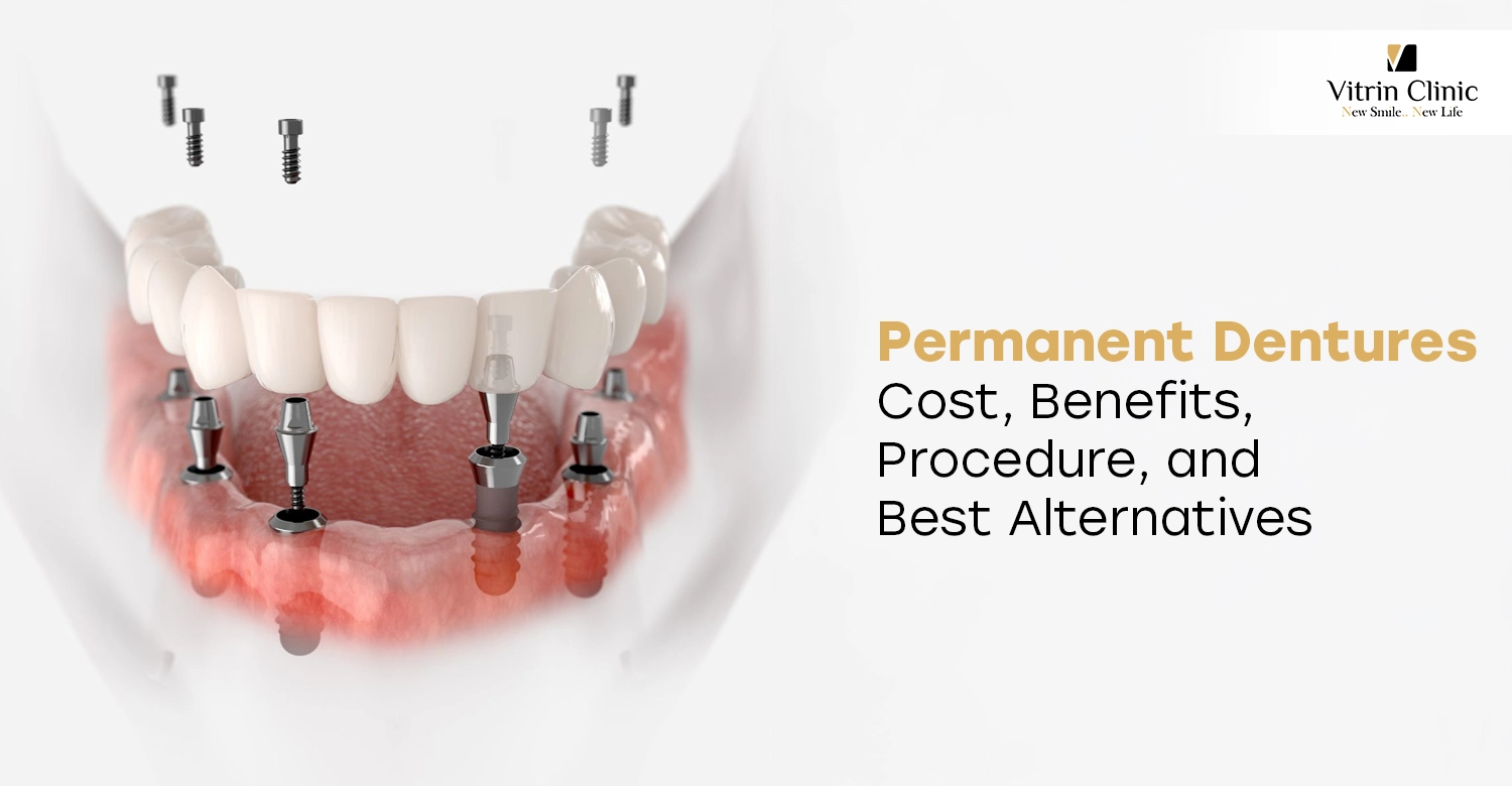 Permanent Dentures