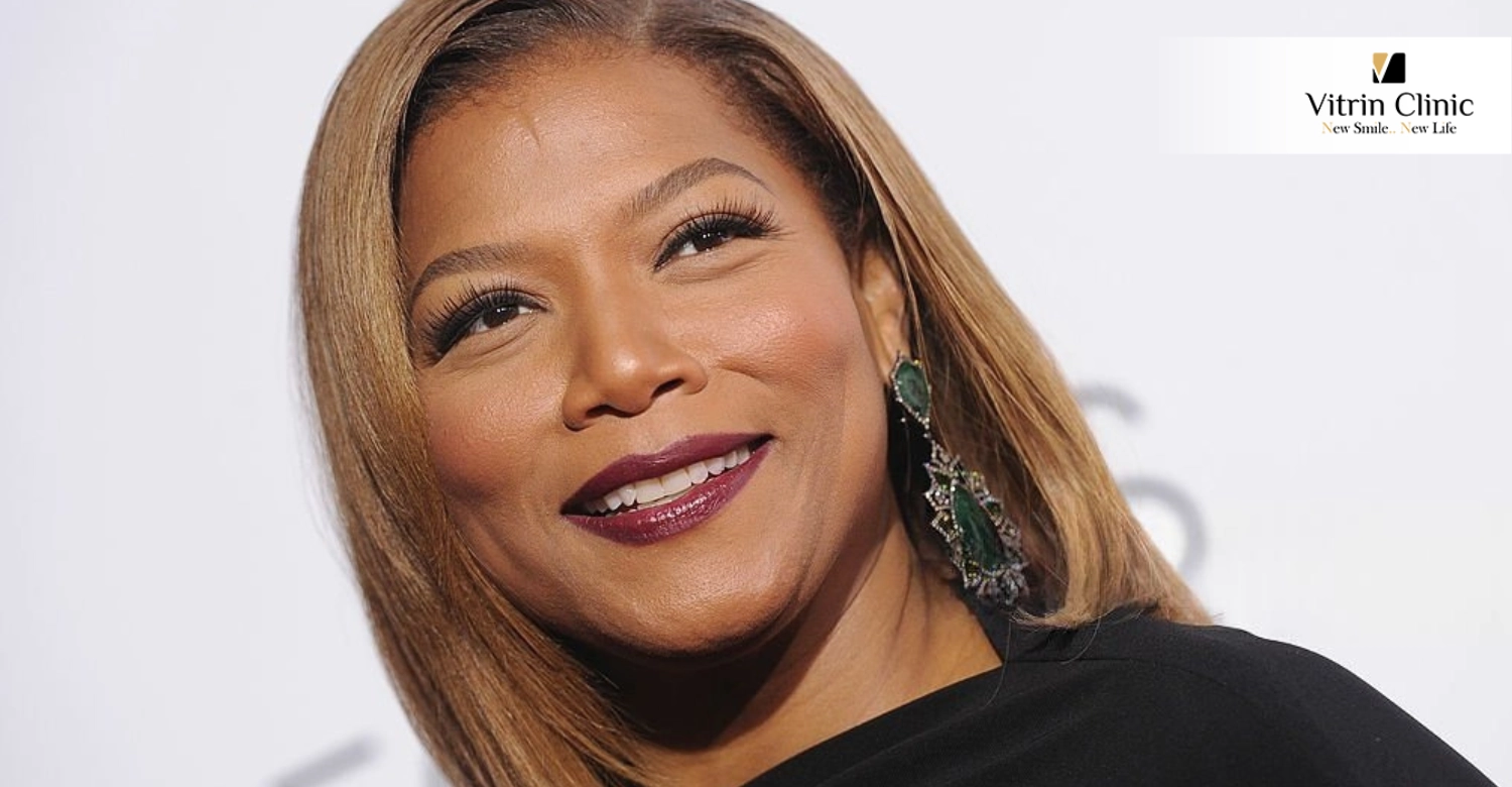 Queen Latifah teeth