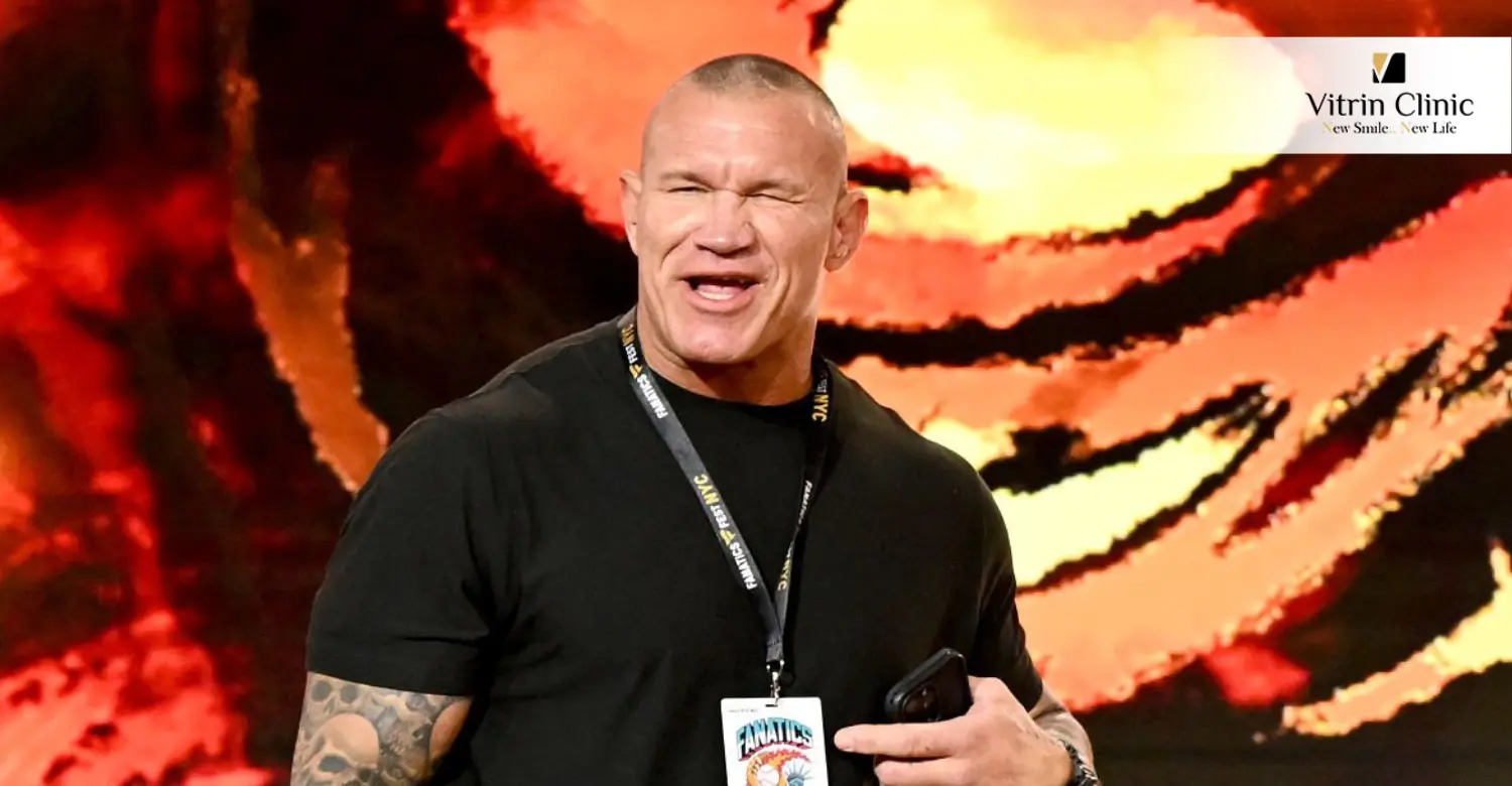 Randy Orton teeth