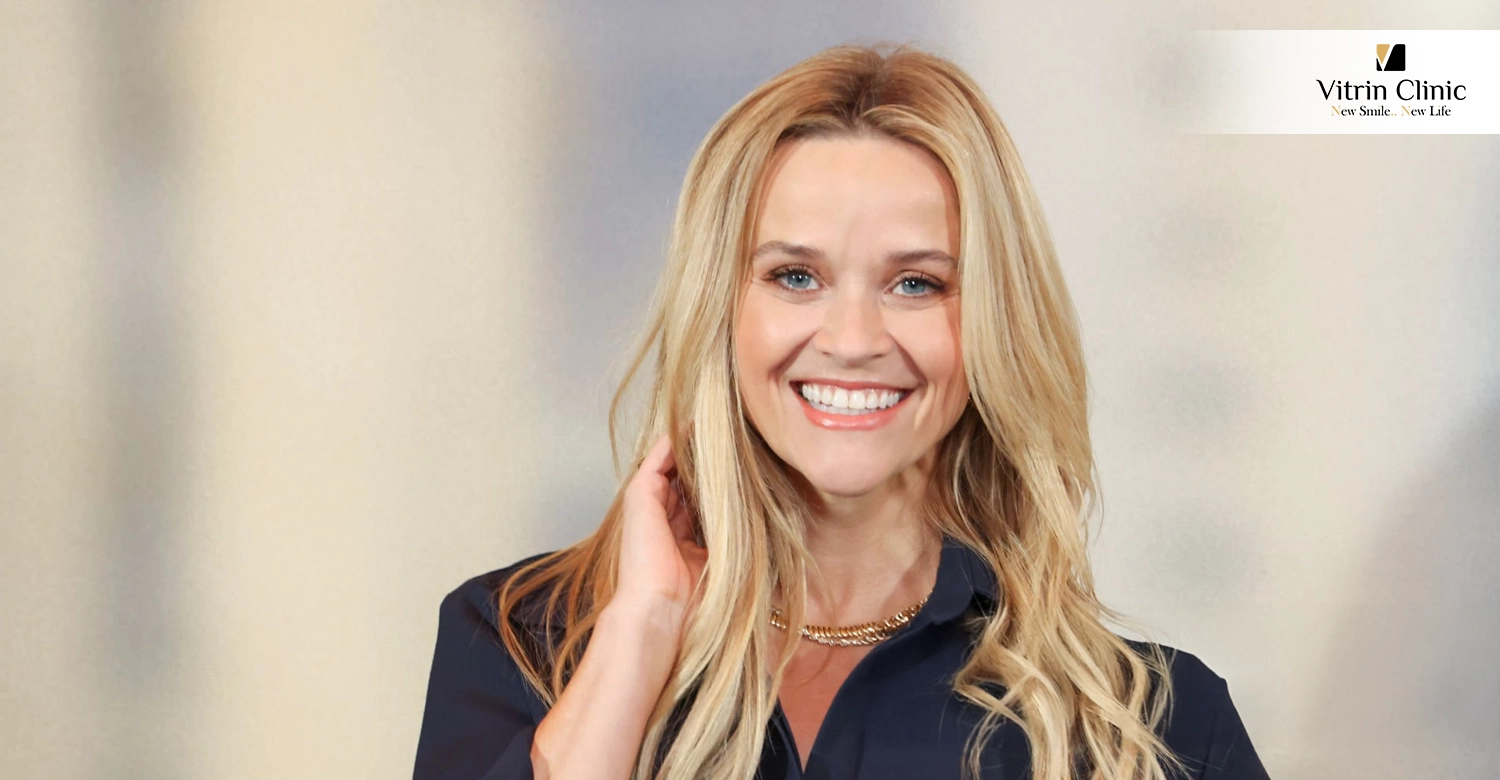 Reese Witherspoon Teeth