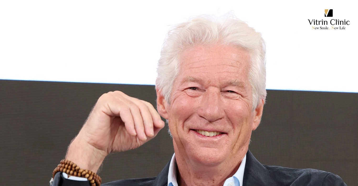Richard Gere Teeth