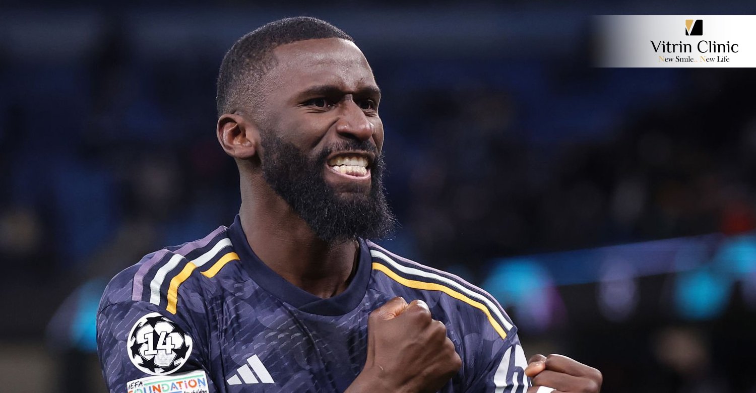 Rüdiger teeth