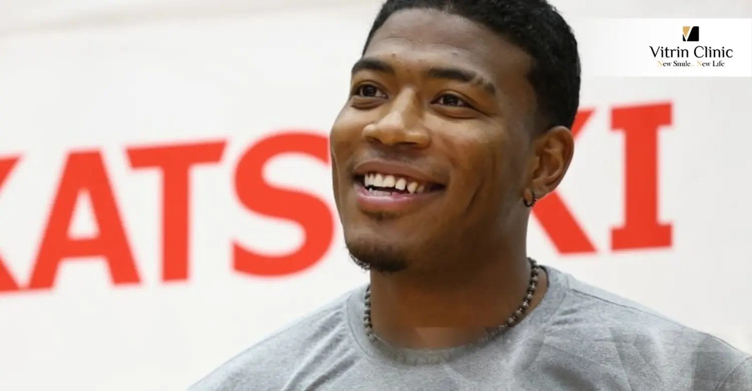 Rui Hachimura teeth