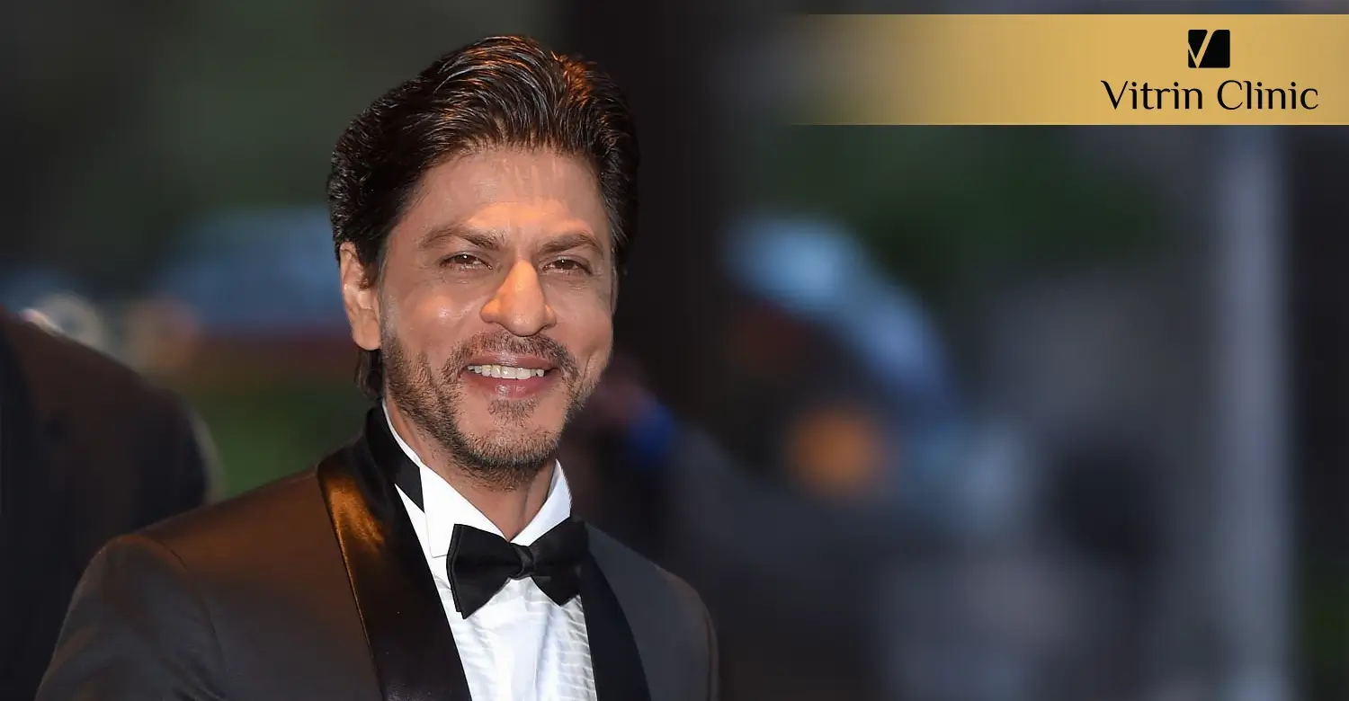 Shah Rukh Khan Teeth