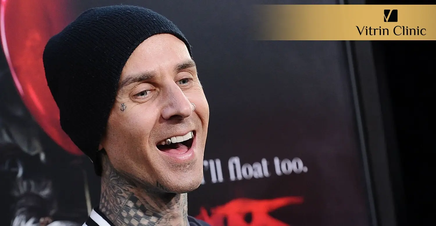 Travis Barker Teeth