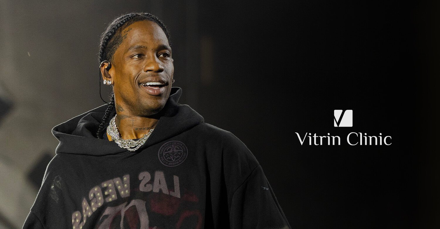 Travis Scott Teeth