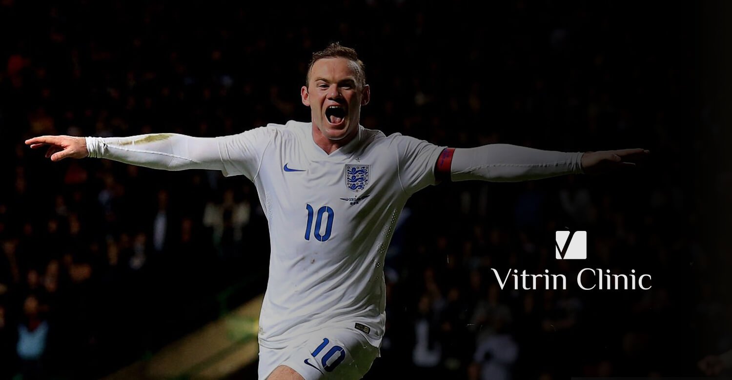 Wayne Rooney Teeth