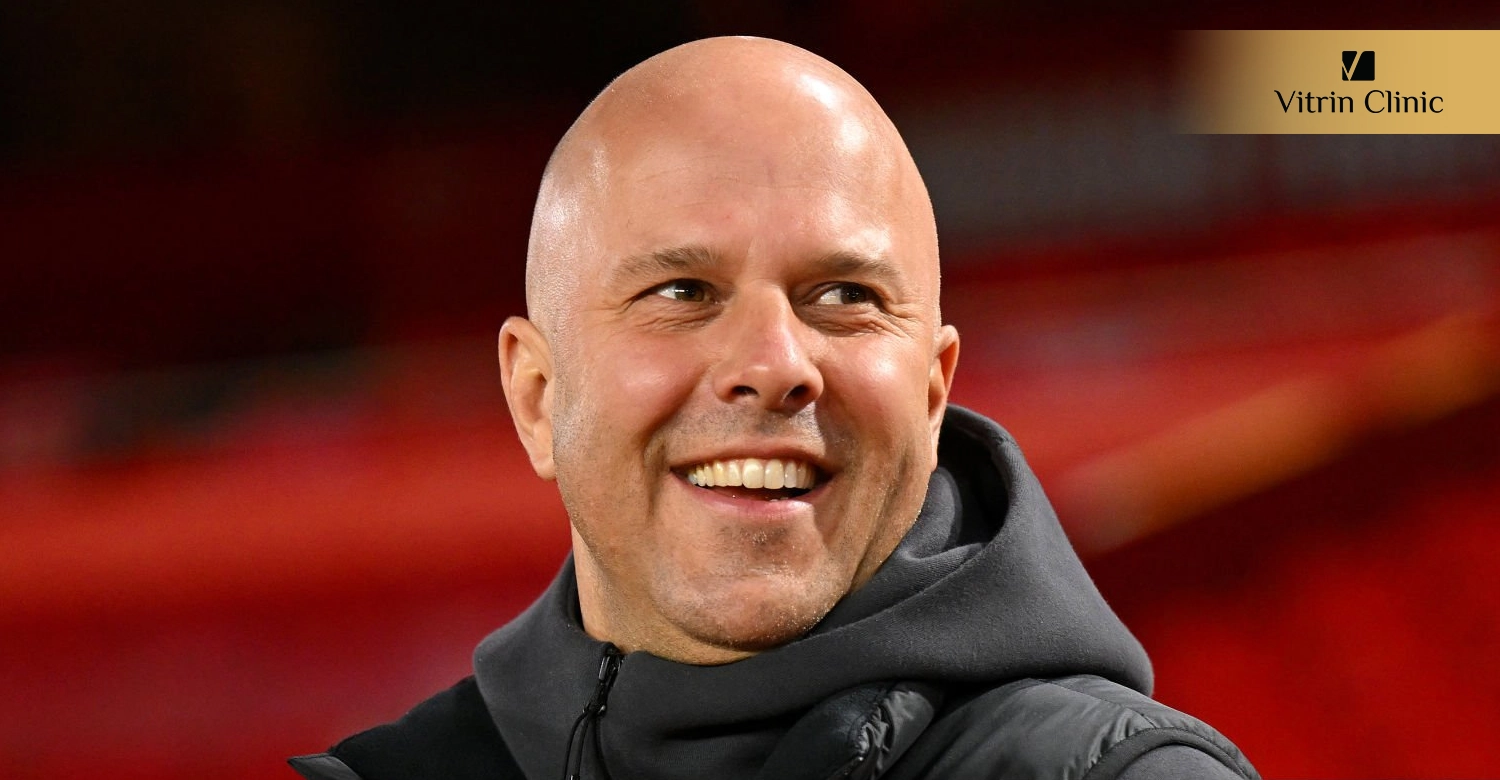 Arne Slot Teeth