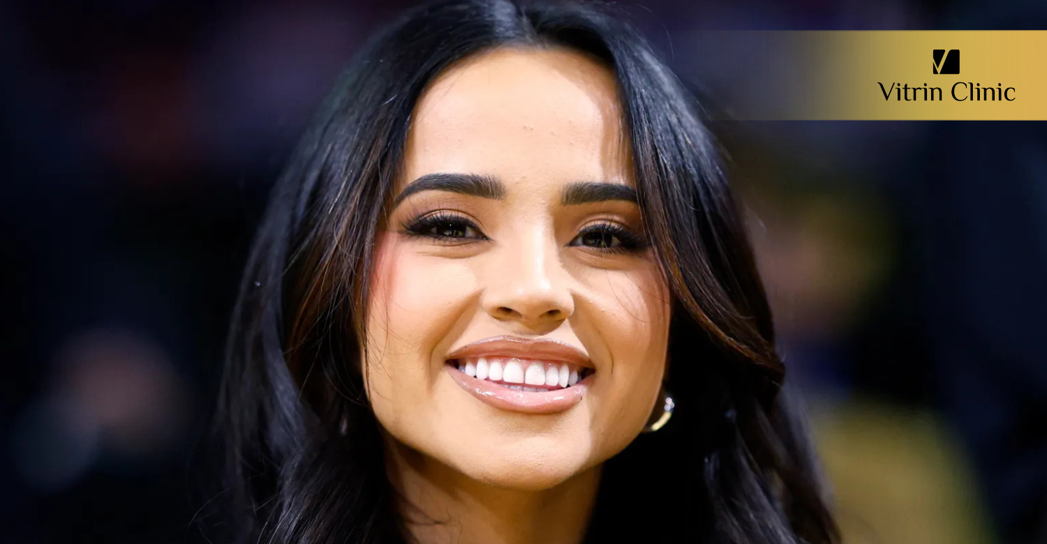 Why Is Becky G's Smile So Recognizable?