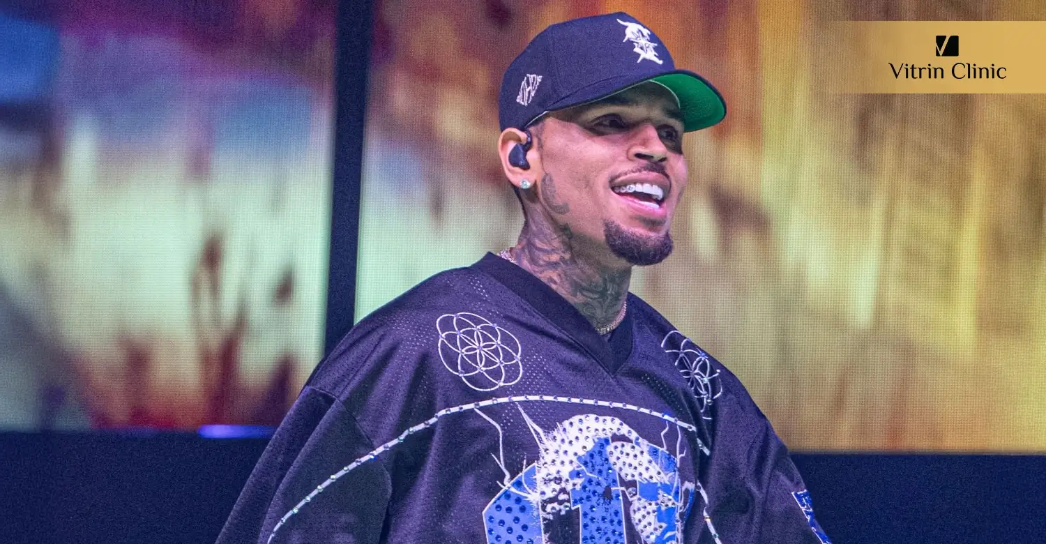 Dental Procedures to Recreate a Chris Brown-Inspired Smile