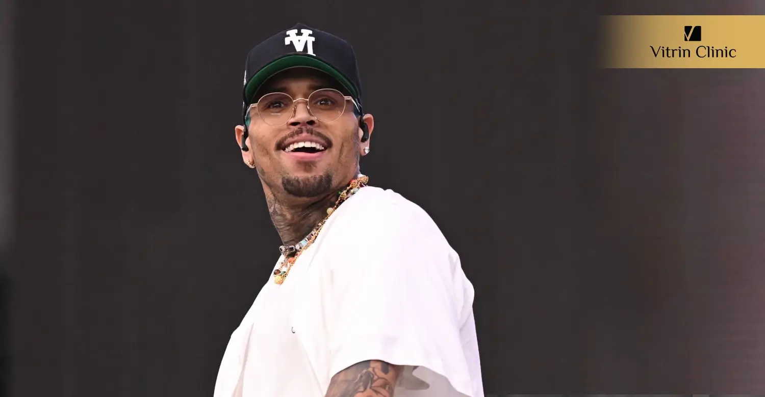 Did Chris Brown Get Veneers or Cosmetic Dental Work?