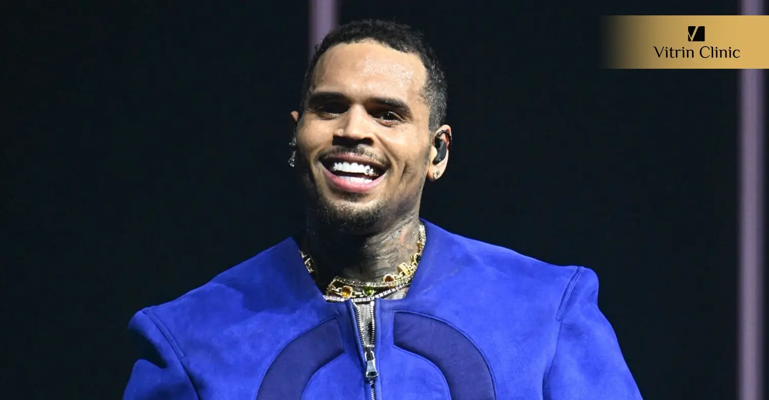 Signs of Professional Dental Work in Chris Brown's Smile