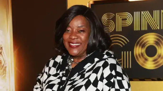 Loretta Devine Teeth