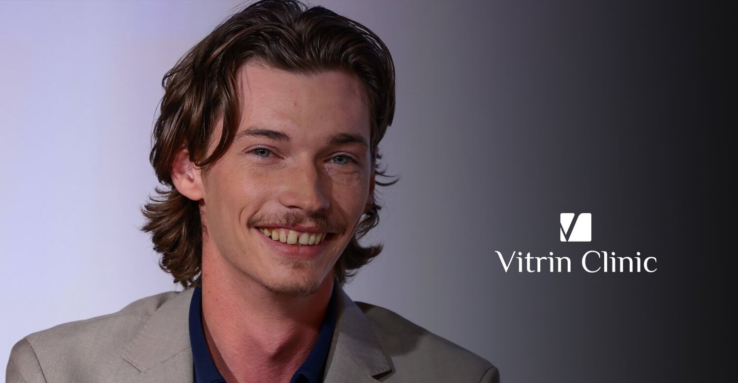 Jacob Lofland Teeth
