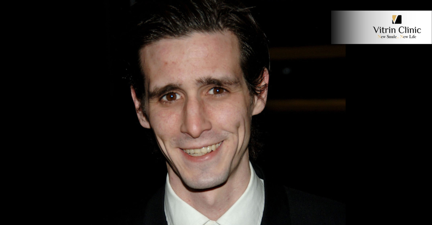 James Ransone smile