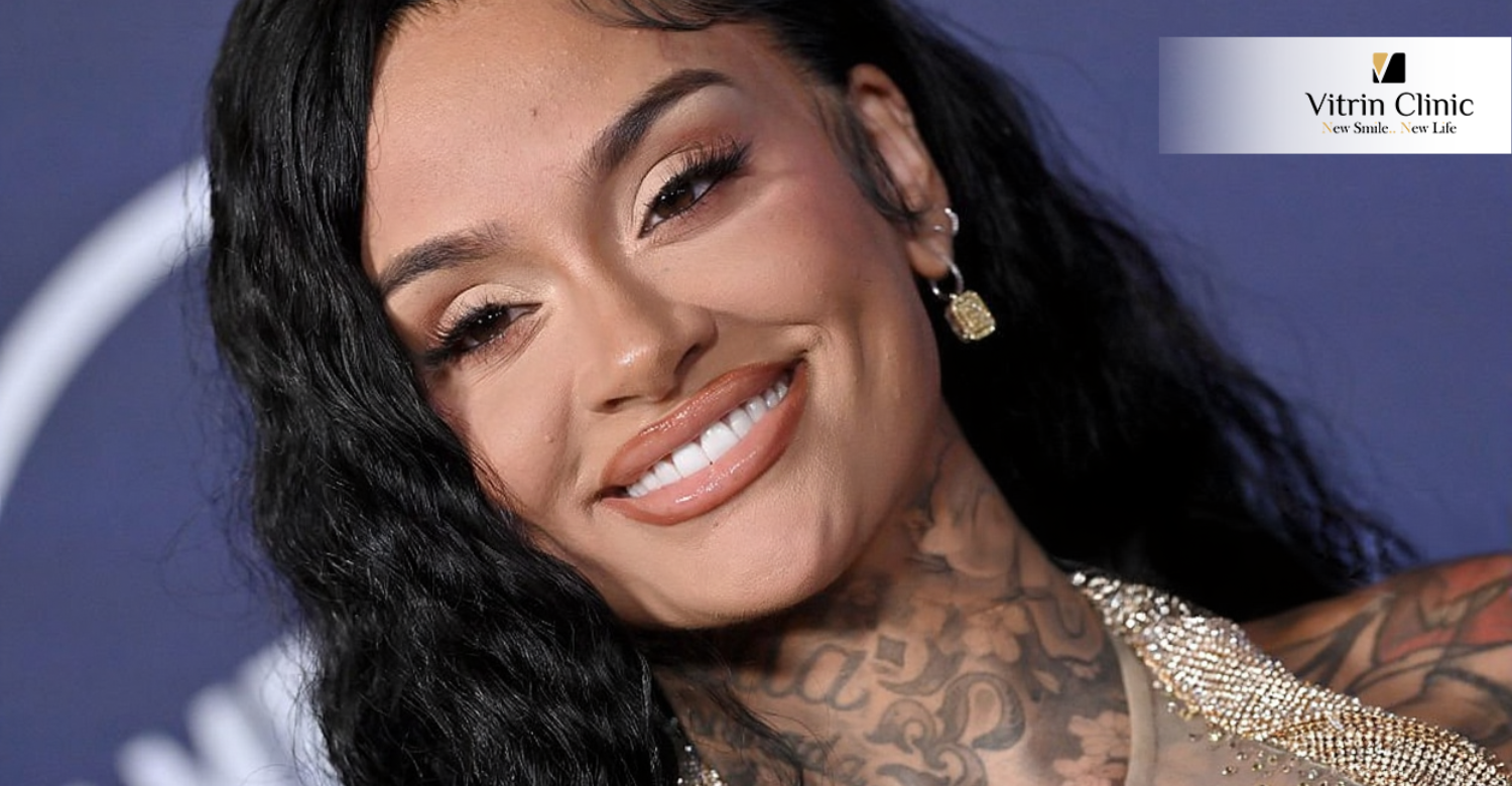 Kehlani teeth