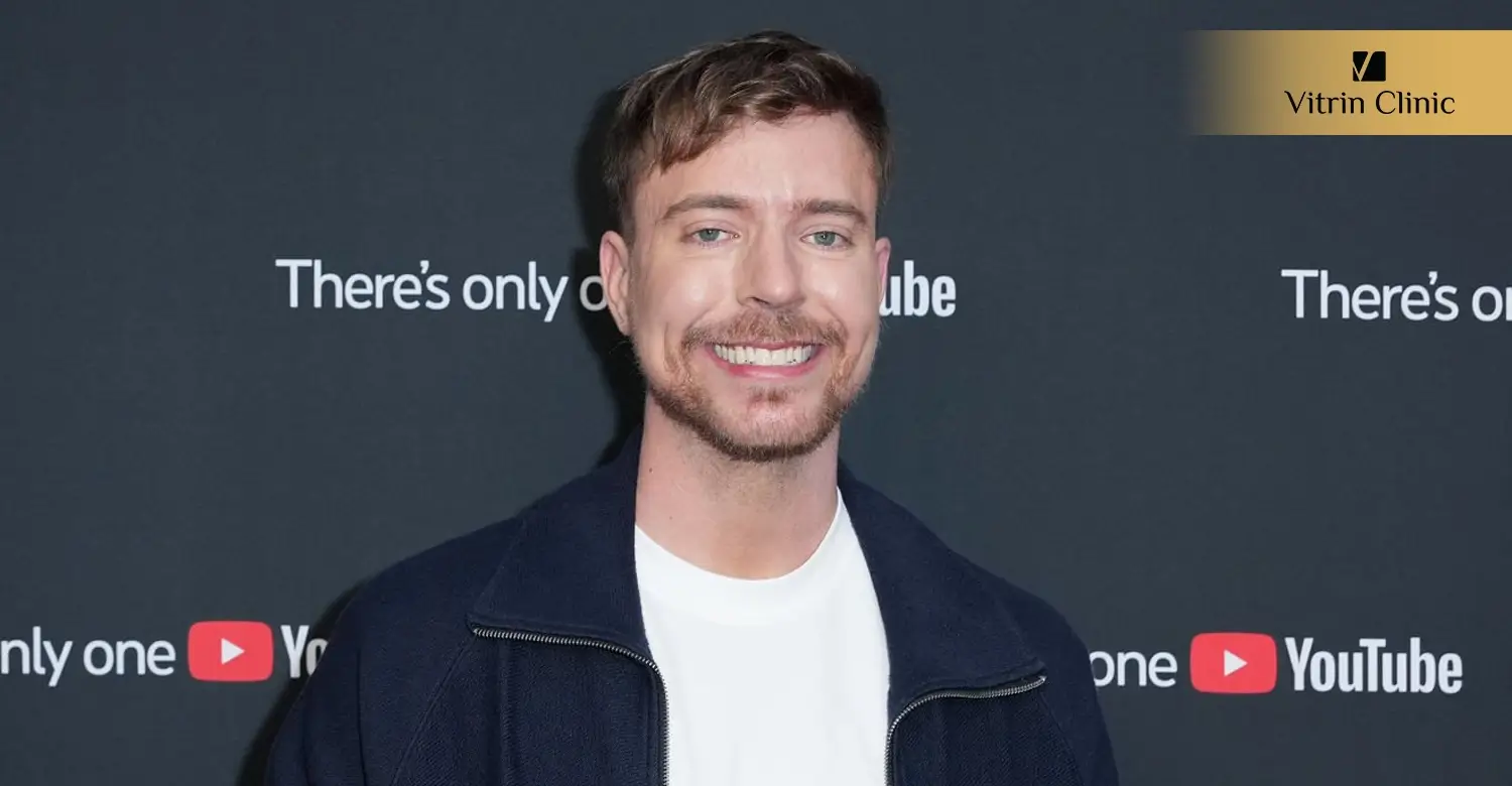 Signs of Professional Dental Work in MrBeast's Smile