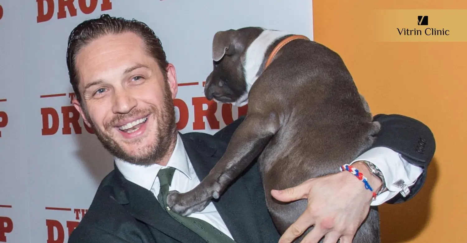 Is Tom Hardy Sporting a Hollywood Smile?