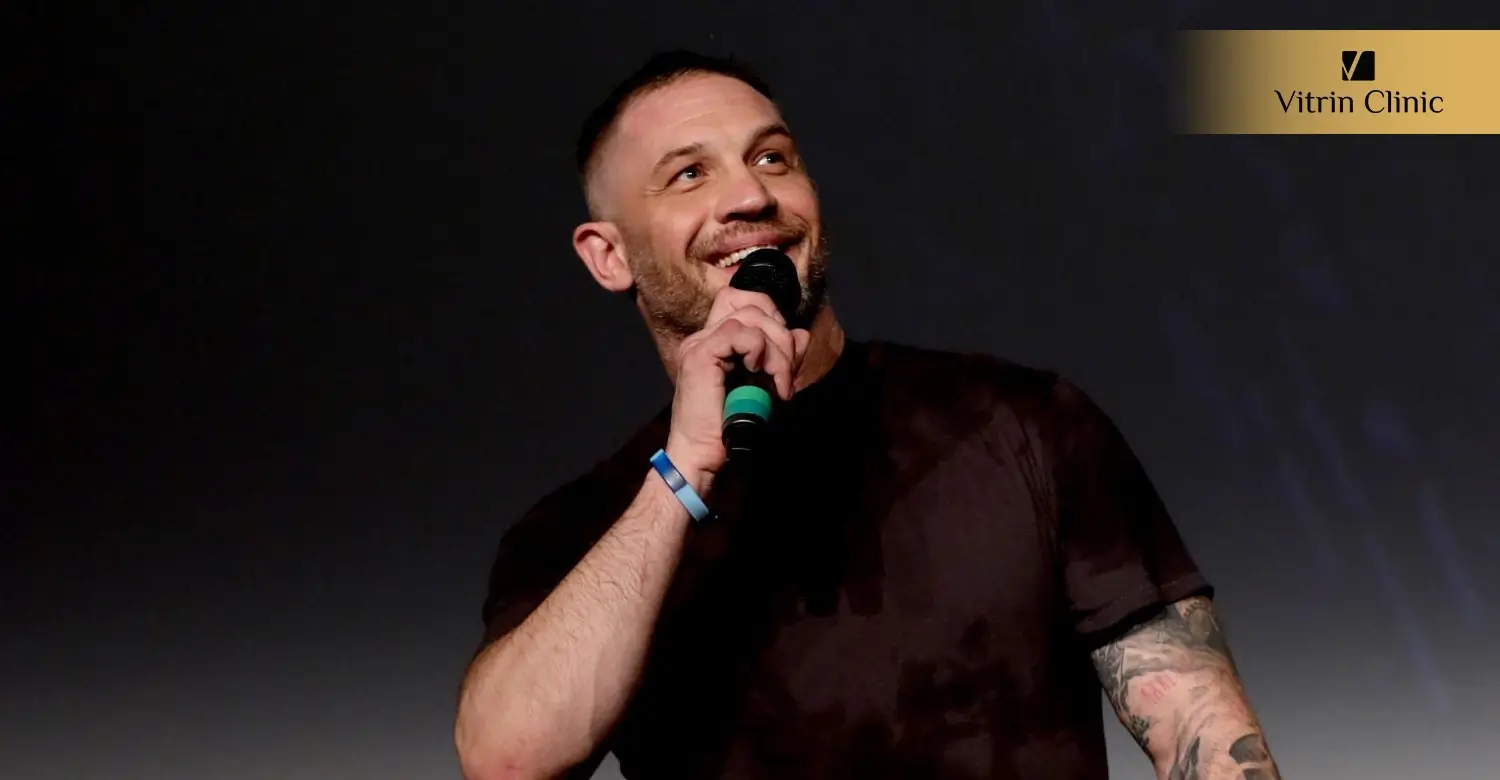 Tom Hardy Teeth