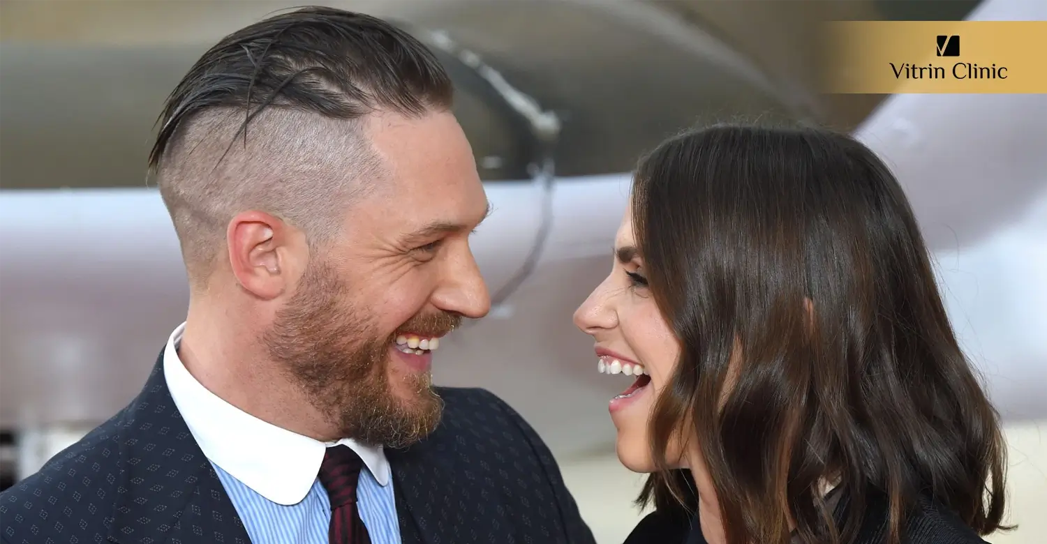 Dental Procedures to Recreate a Tom Hardy-Inspired Smile