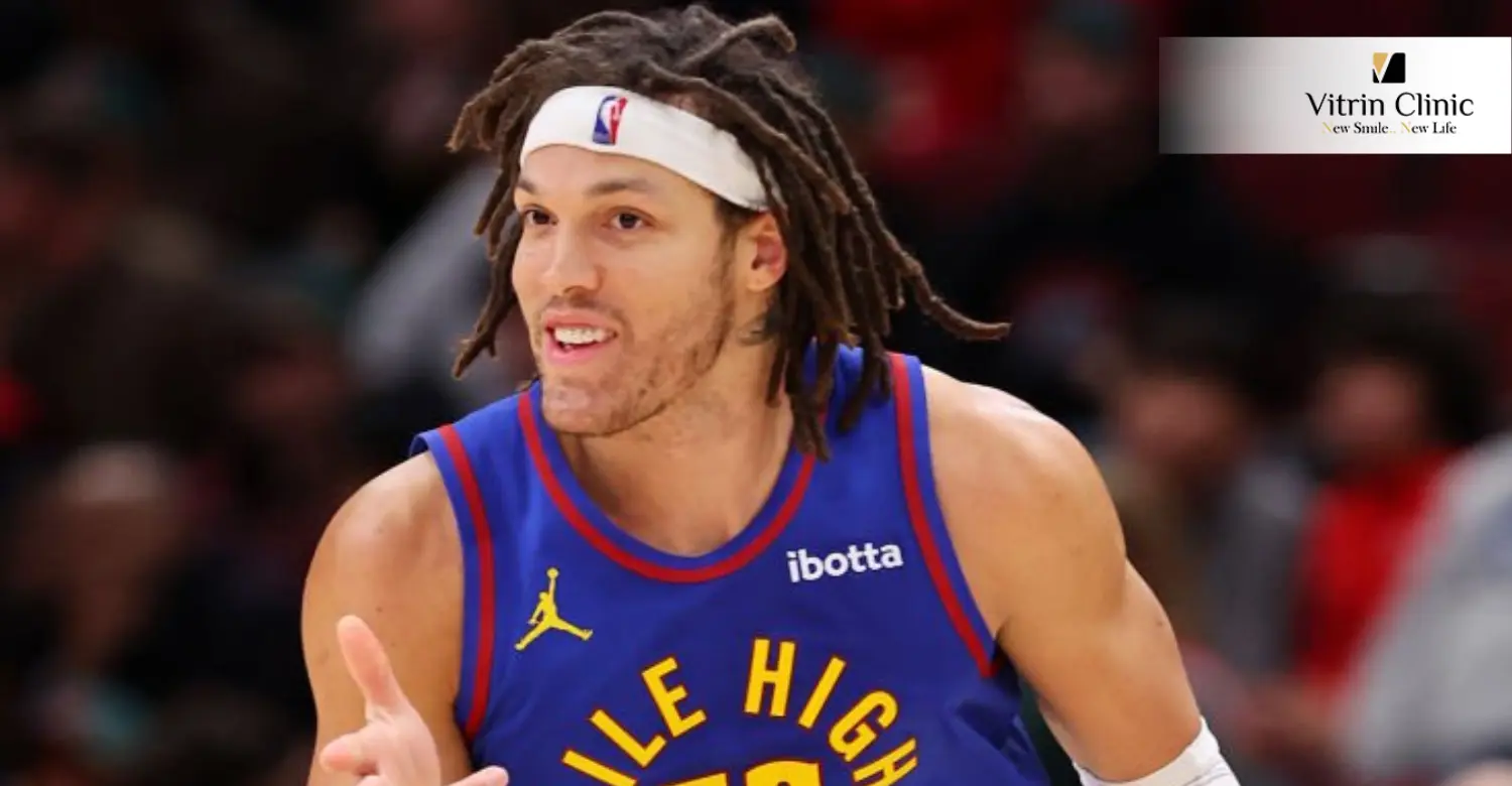 Aaron Gordon teeth
