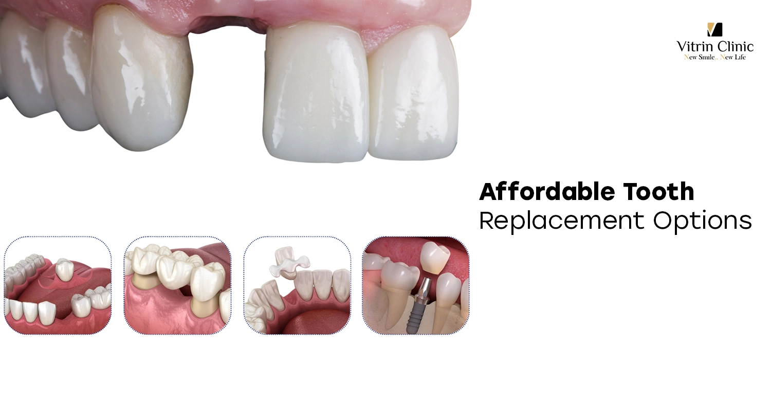 Affordable Tooth Replacement Options