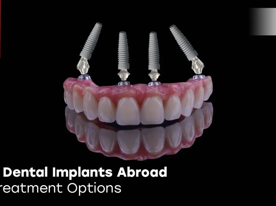 all on 4 dental implants abroad
