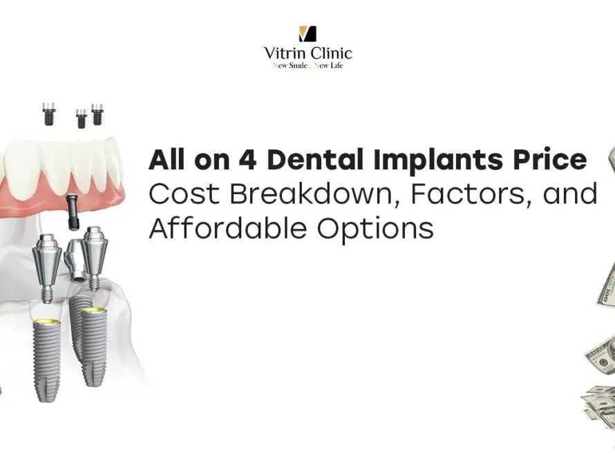 all on 4 dental implants price