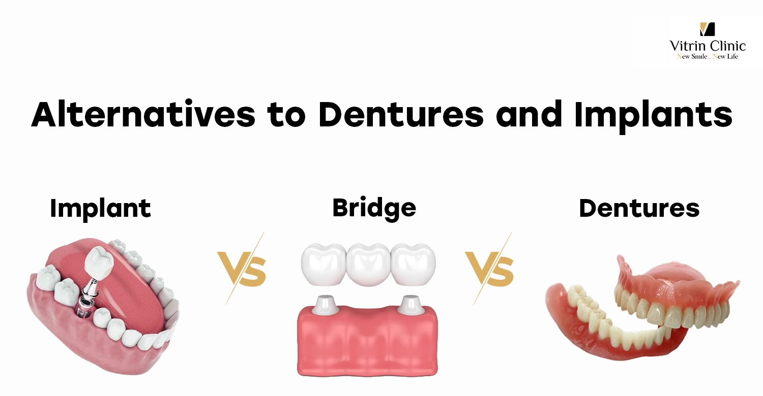 Alternatives to Dentures and Implants