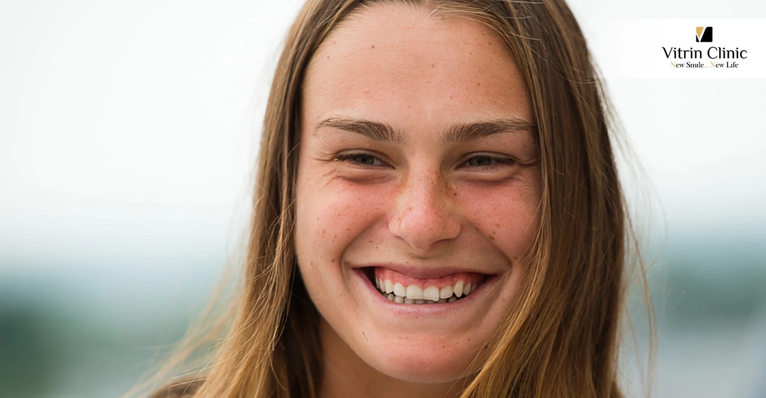 Aryna Sabalenka's Teeth in 2012