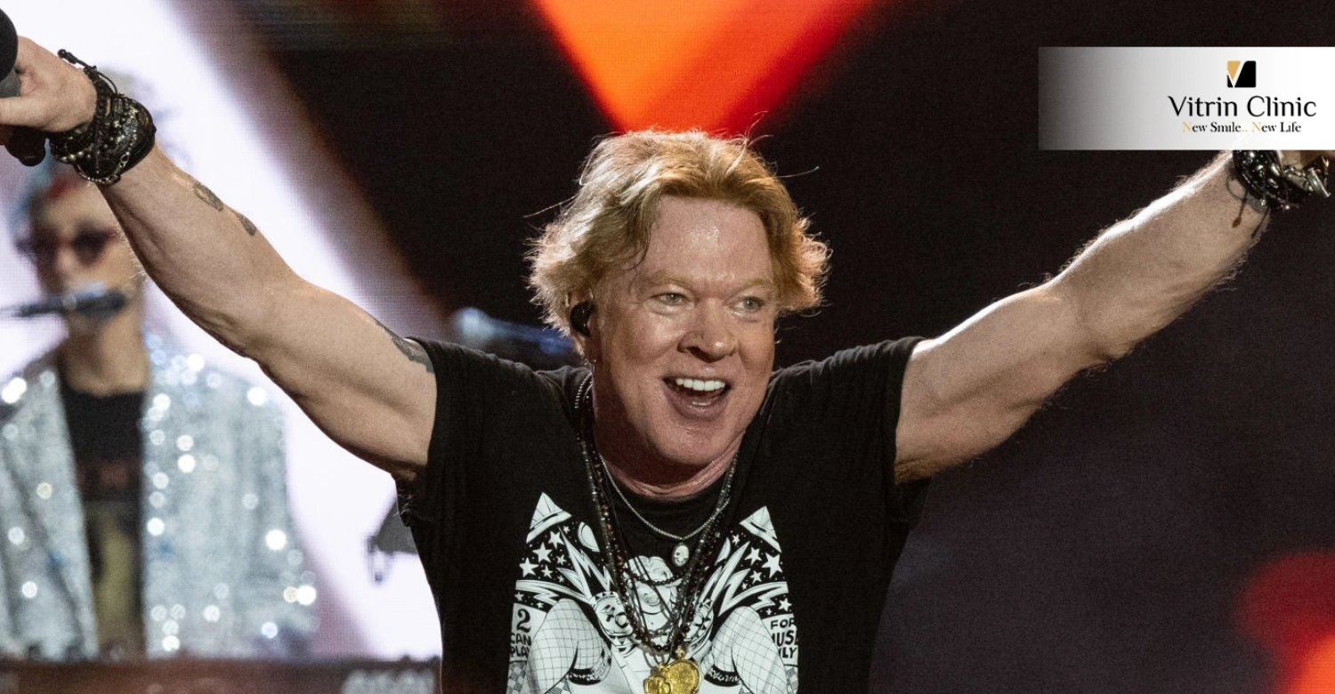 Axl Rose smile