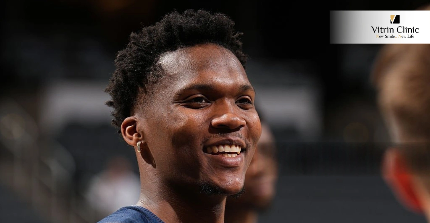 Benedict Mathurin Teeth