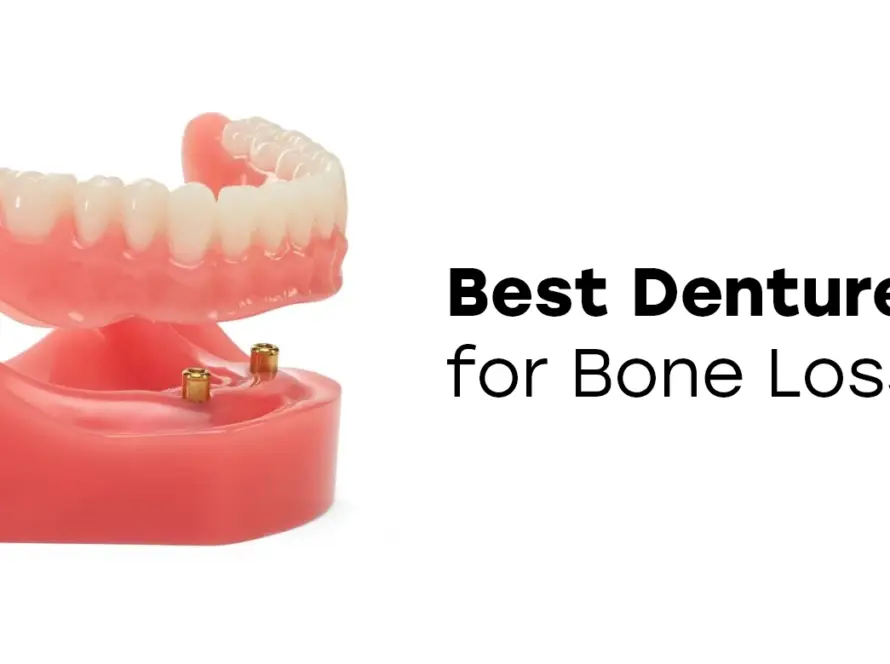 Best Dentures for Bone Loss