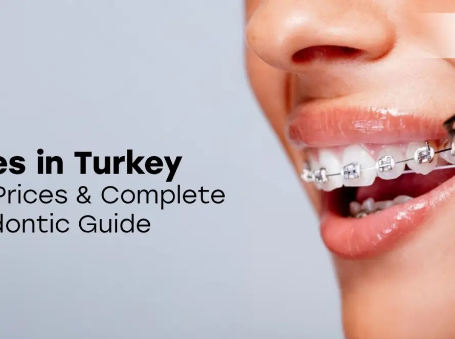 Braces in Turkey
