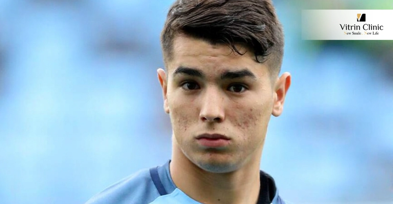 Brahim Diaz's Teeth in 2016