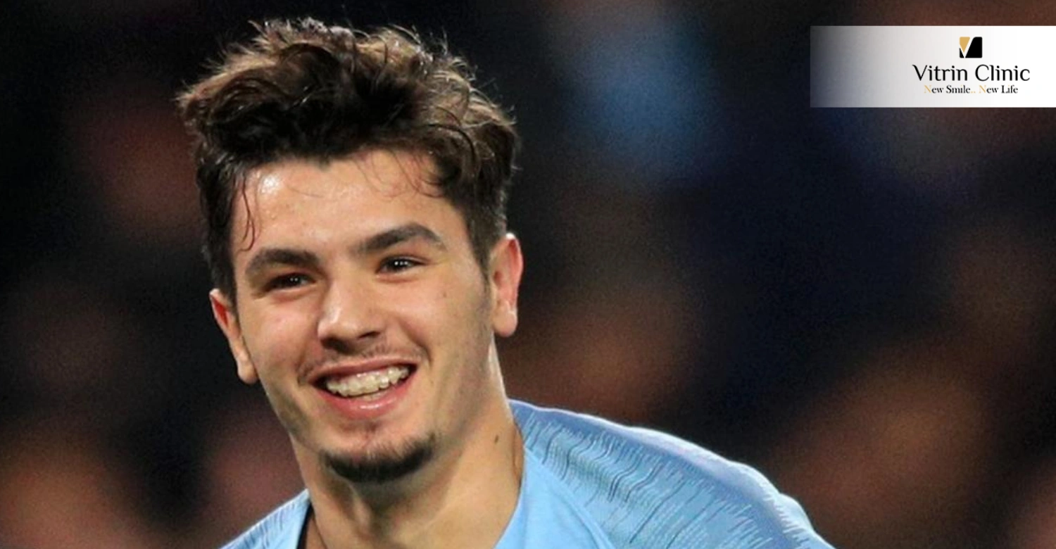 Brahim Diaz's Teeth in 2019